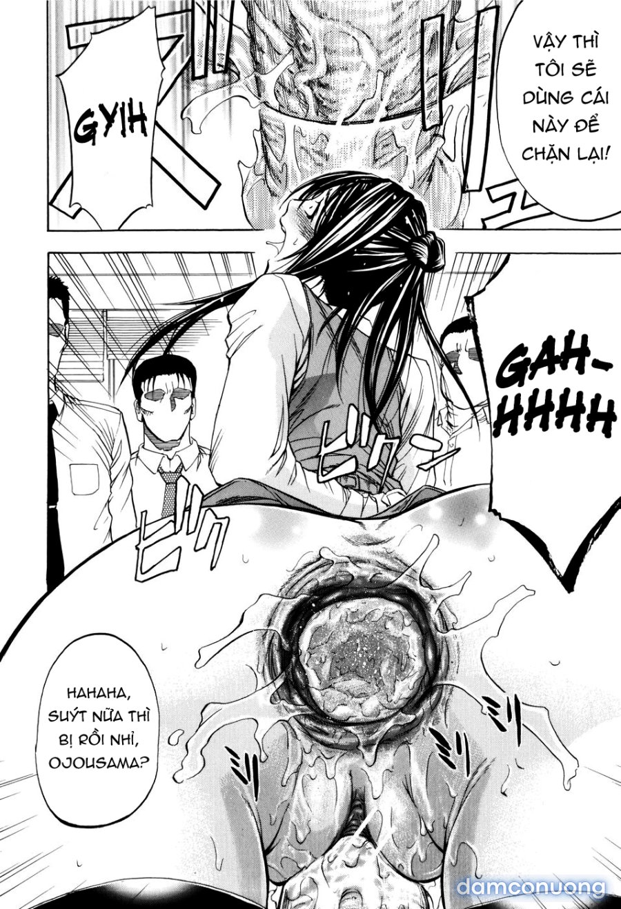 ANAL BACKER 