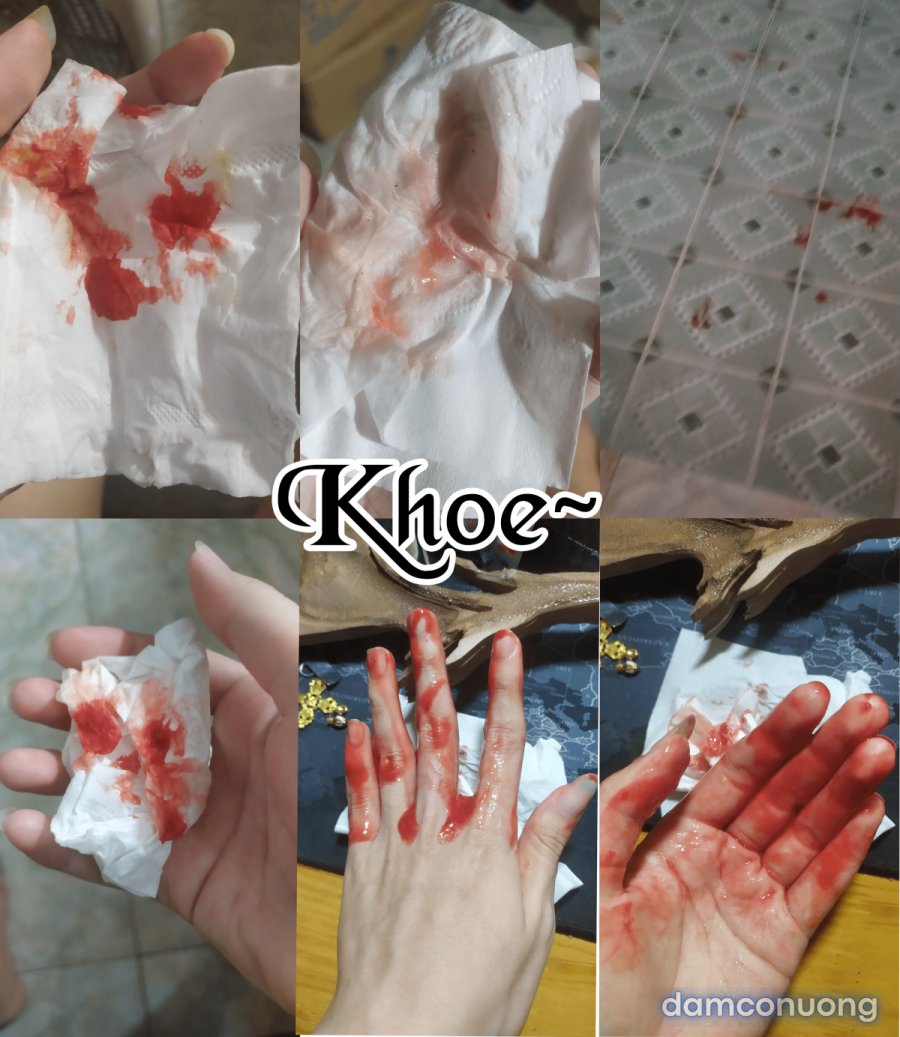 Sau khi tôi ngủ... 